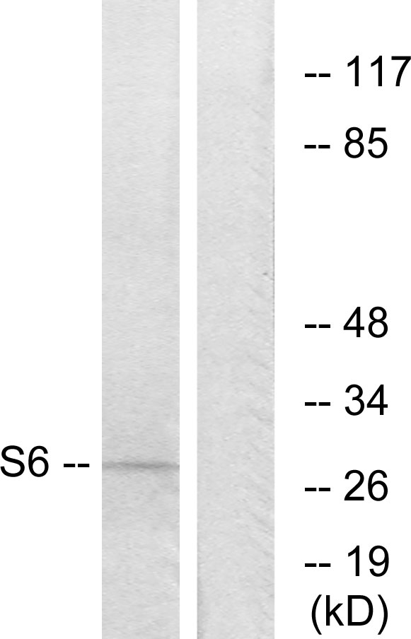 Anti-S6 Ribosomal Protein Antibody