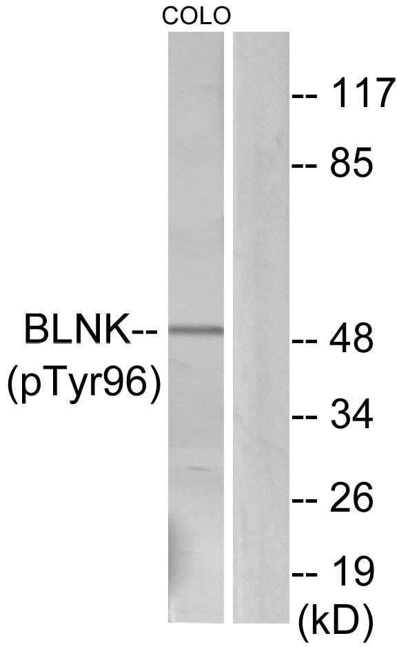 Anti-BLNK (phospho Tyr96) Antibody