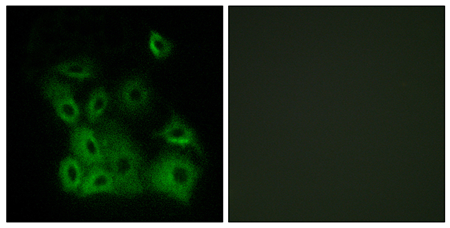 Anti-Bax (phospho Thr167) Antibody