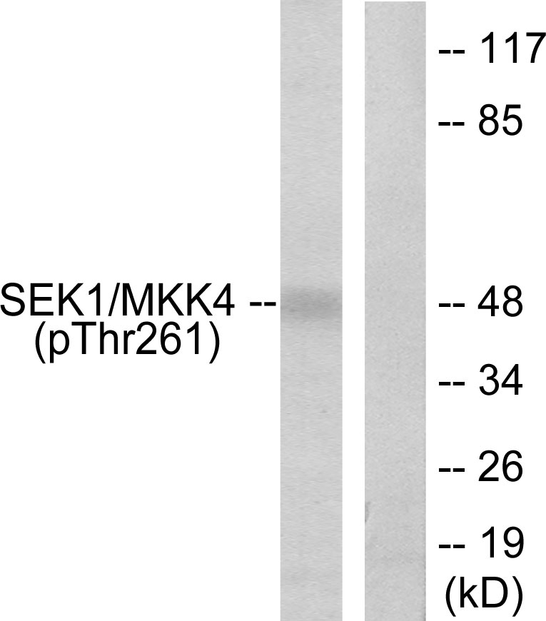 Anti-SEK1 (phospho Thr261) Antibody