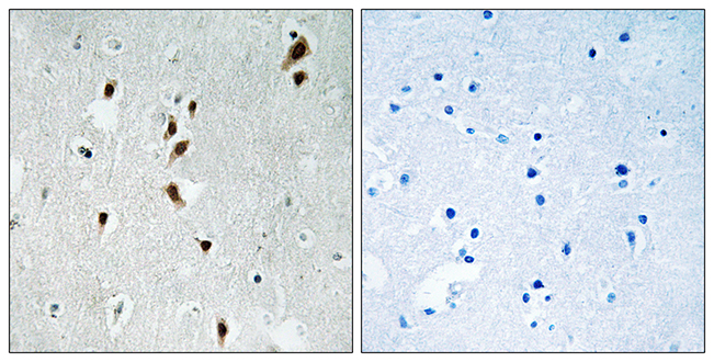 Anti-Mnk1 (phospho Thr385) Antibody