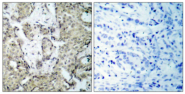 Anti-MKK6 (phospho Ser207) Antibody