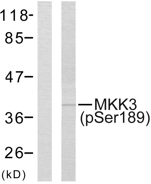 Anti-MKK3 (phospho Ser189) Antibody