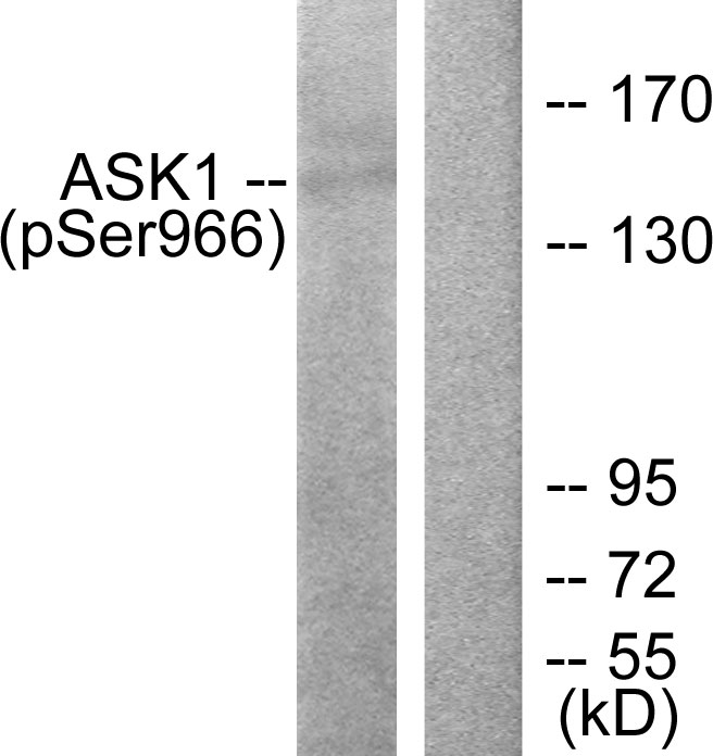 Anti-ASK1 (phospho Ser966) Antibody