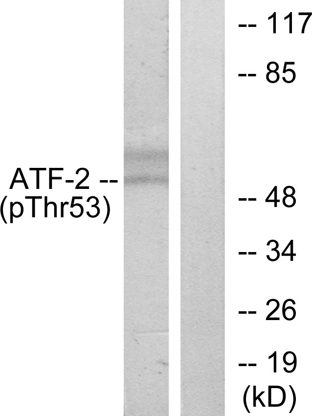 Anti-ATF2 (phospho Thr71 or 53) Antibody - Identical to Abcam (ab28847)