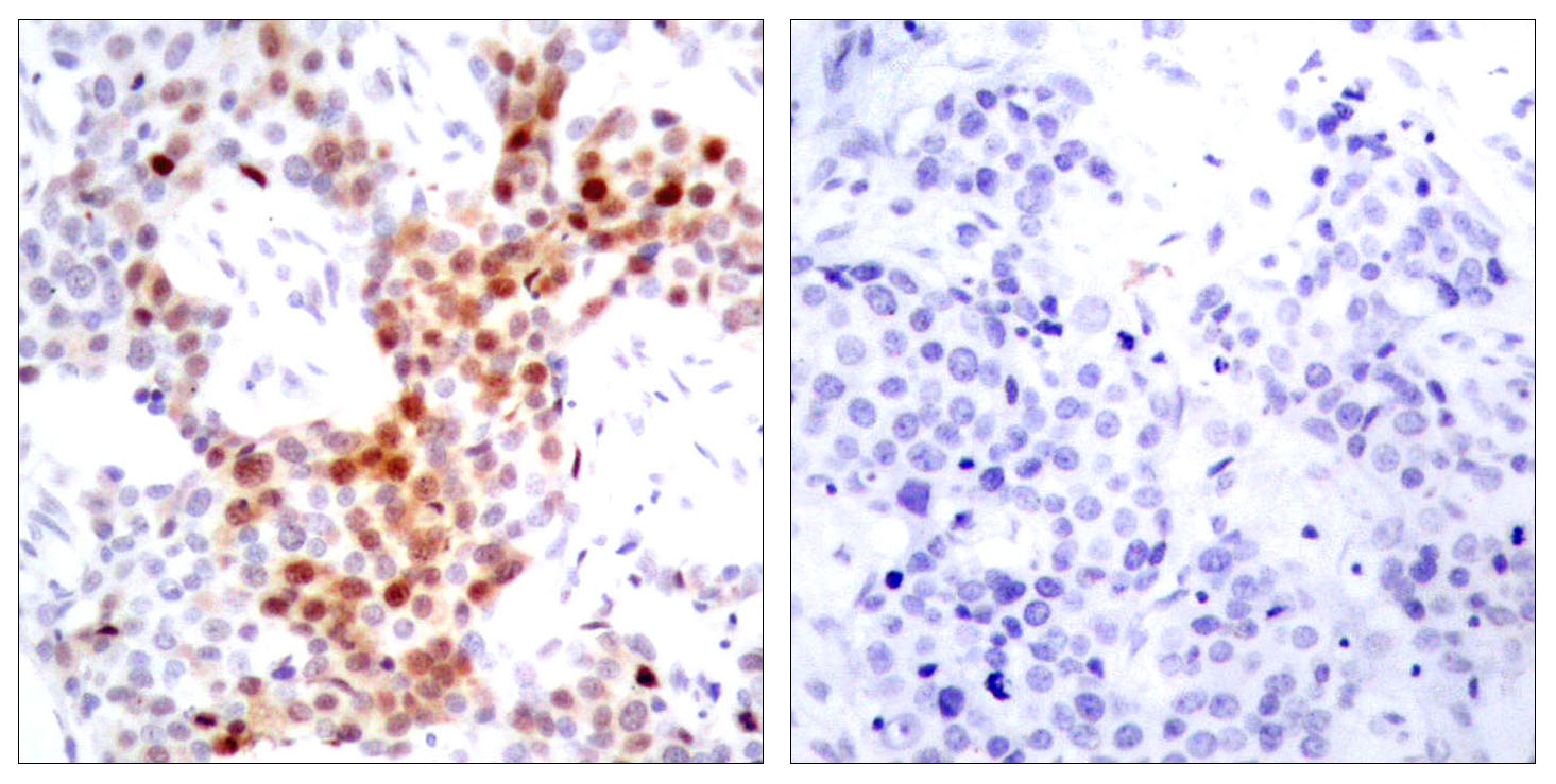 Anti-ATF2 (phospho Thr69 or 51) Antibody