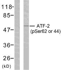 Anti-ATF2 (phospho Ser62 or 44) Antibody - Identical to Abcam (ab28847)