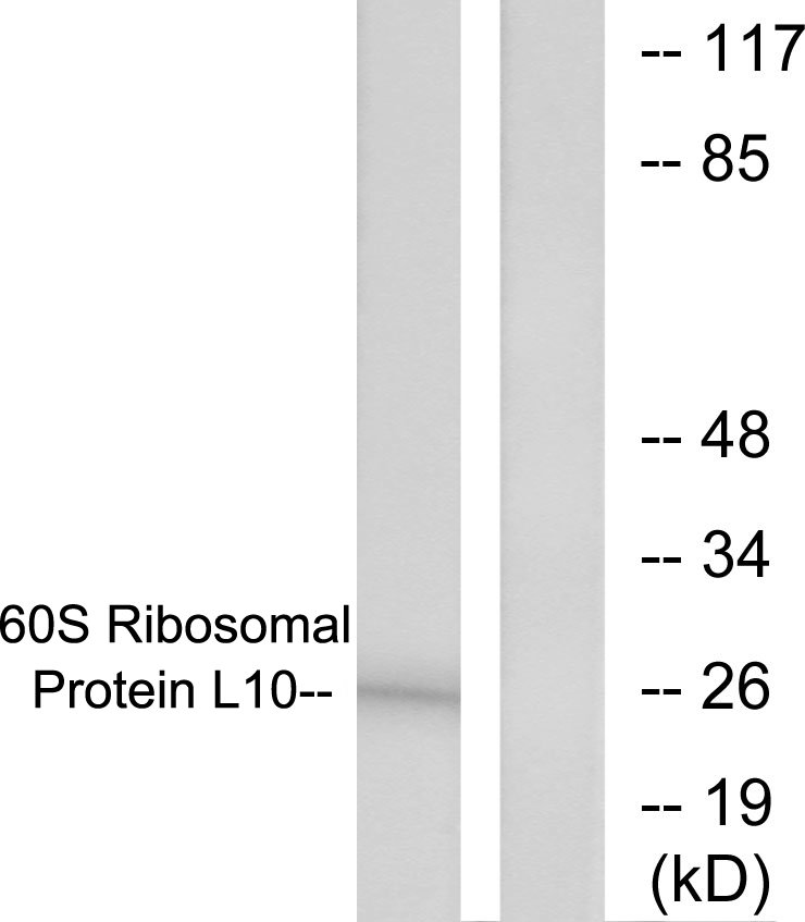 Anti-60S Ribosomal Protein L10 Antibody