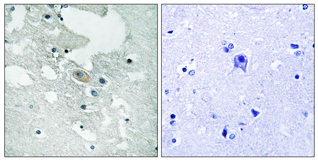 Anti-BLNK (phospho Tyr84) Antibody