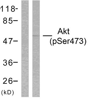 Anti-Akt (phospho Ser473) Antibody