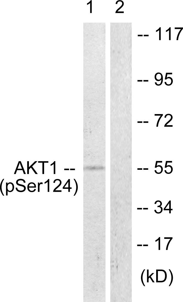 Anti-Akt (phospho Ser124) Antibody