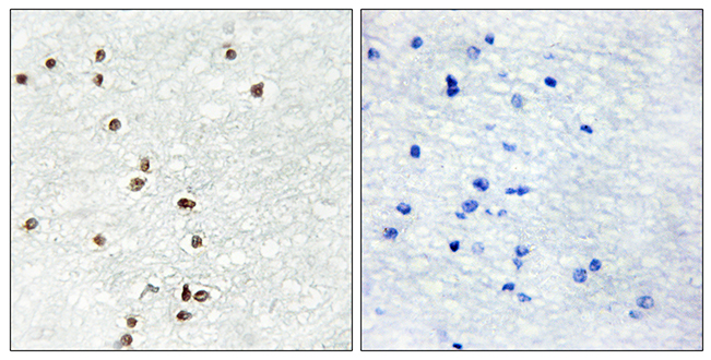 Anti-ZIC1 + ZIC2 + ZIC3 Antibody