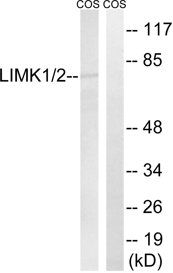 Anti-LIMK1 + LIMK2 Antibody - Identical to Abcam (ab51200)