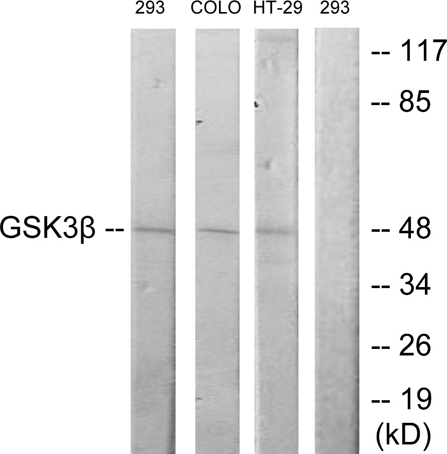 Anti-GSK3 beta Antibody - Identical to Abcam (ab131356)