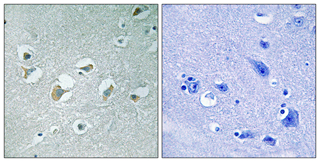 Anti-MLK1 + MLK2 (phospho Thr312 + Thr266) Antibody