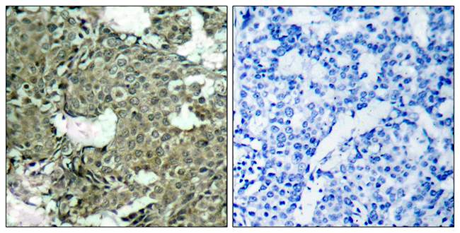 Anti-MEK1 + MEK2 (phospho Ser221) Antibody