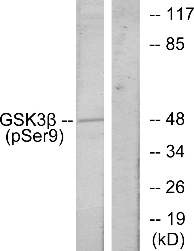 Anti-GSK3 beta (phospho Ser9) Antibody - Identical to Abcam (ab131097)