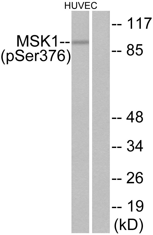 Anti-MSK1 (phospho Ser376) Antibody