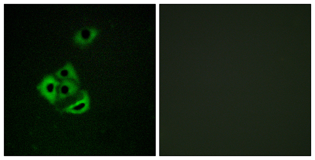 Anti-MCL1 (phospho Ser159) Antibody - Identical to Abcam (ab111574)