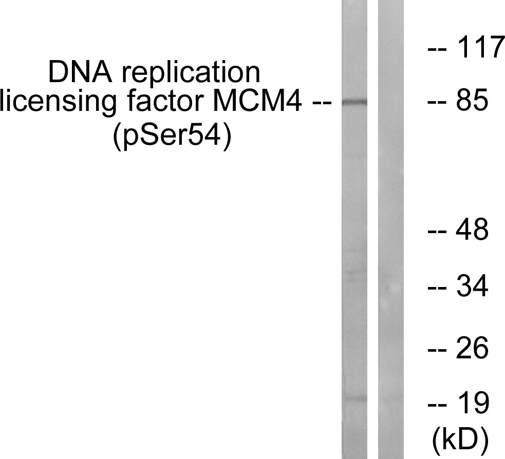 Anti-MCM4 (phospho Ser54) Antibody