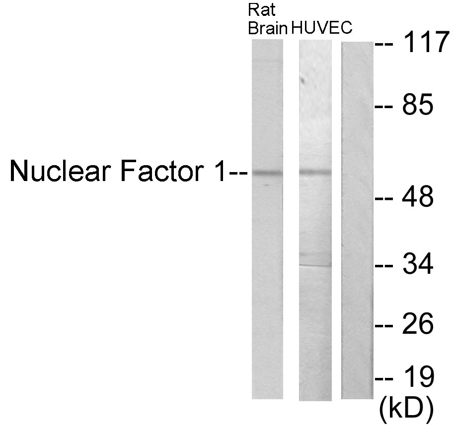 Anti-Nuclear Factor 1 Antibody