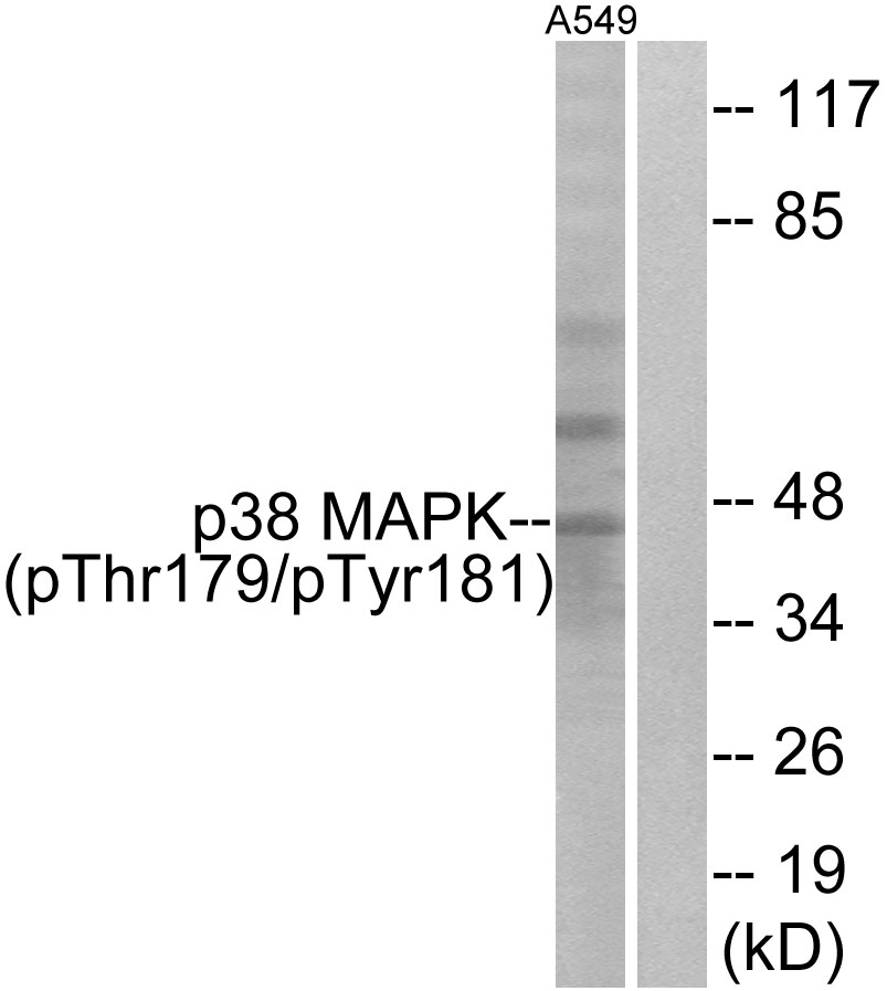 Anti-p38 MAPK (phospho Thr179+Tyr181) Antibody