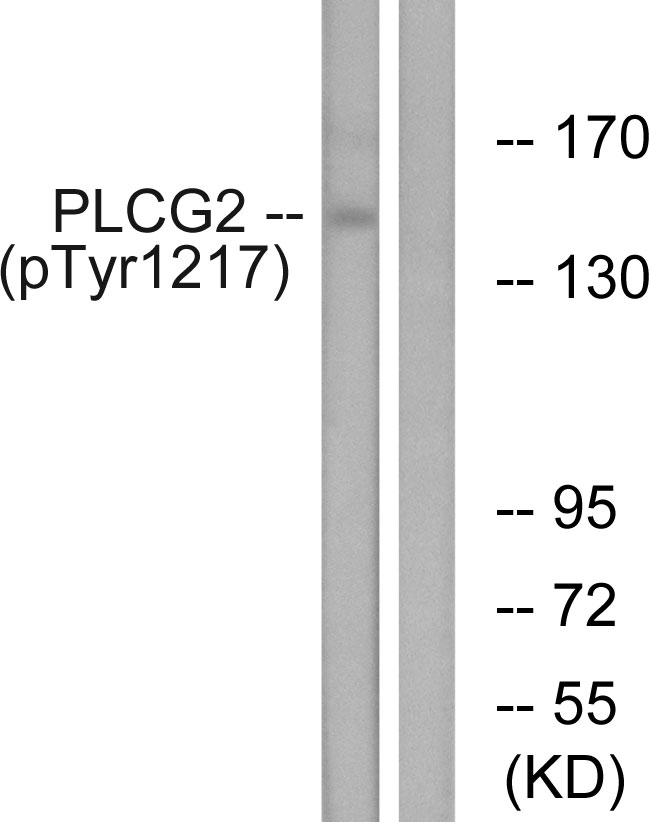 Anti-PLCG2 (phospho Tyr1217) Antibody