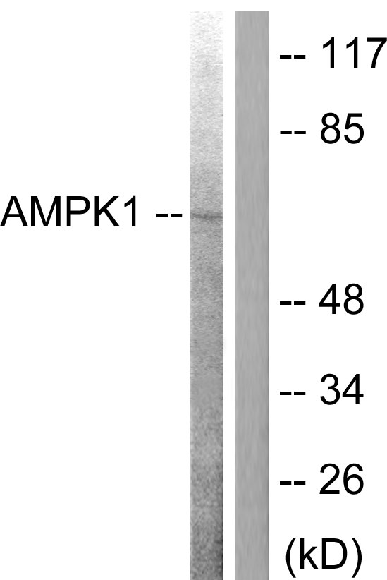 Anti-AMPK alpha Antibody