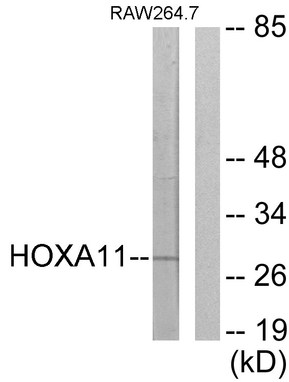Anti-HOXA11 + HOXD11 Antibody
