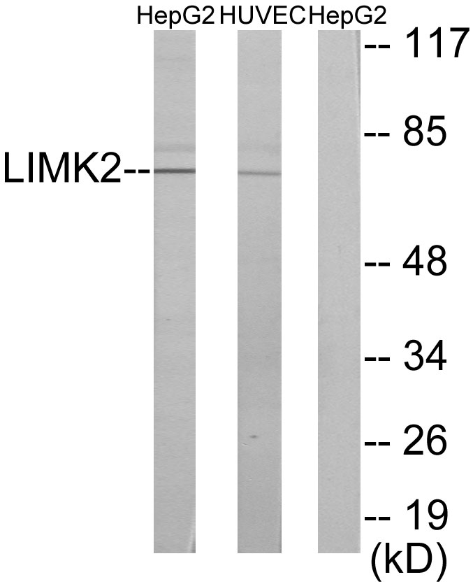 Anti-LIMK2 Antibody