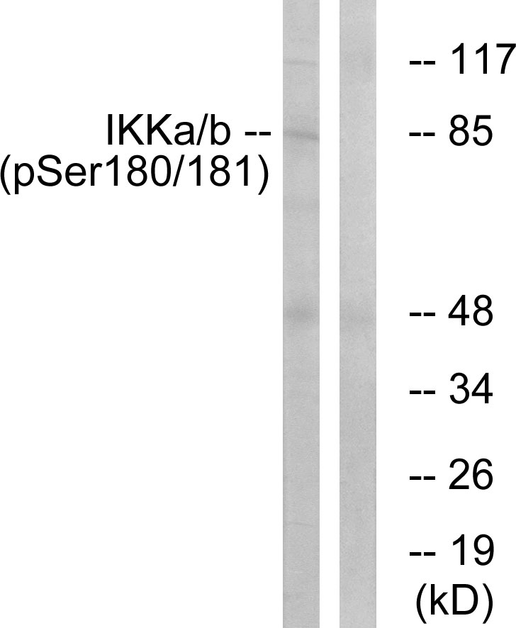 Anti-IKK alpha + beta (phospho Ser180 + Ser181) Antibody