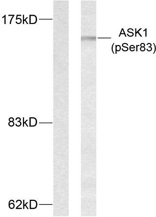 Anti-ASK1 (phospho Ser83) Antibody - Identical to Abcam (ab47304)