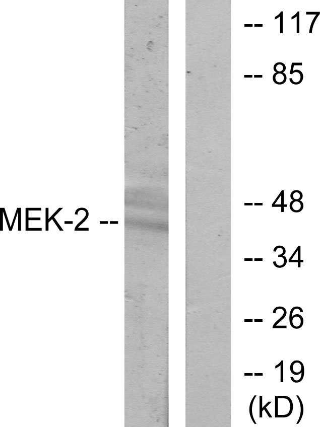 Anti-MEK2 Antibody