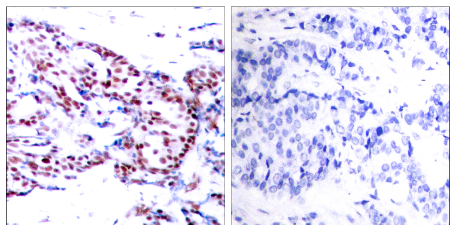 Anti-ATF2 Antibody - Identical to Abcam (ab47476)