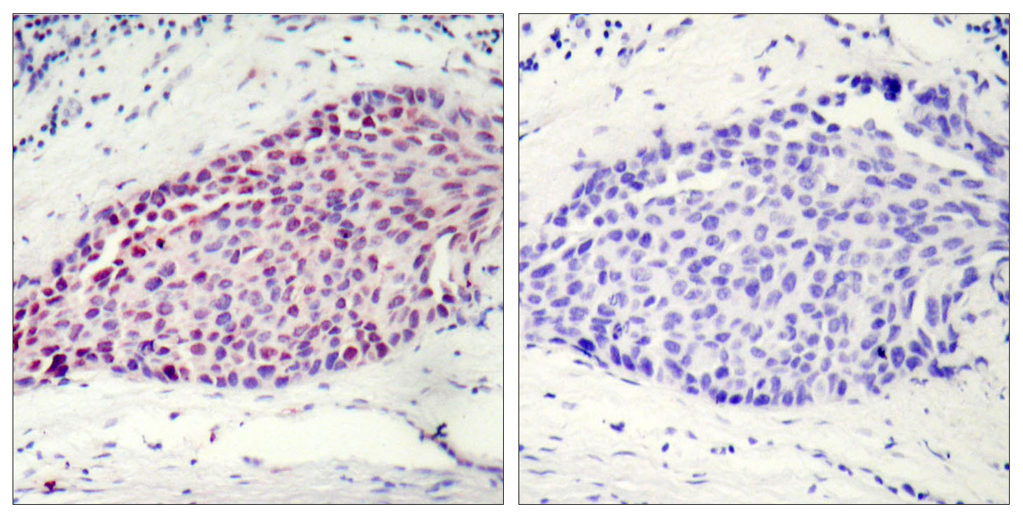 Anti-ATF2 Antibody