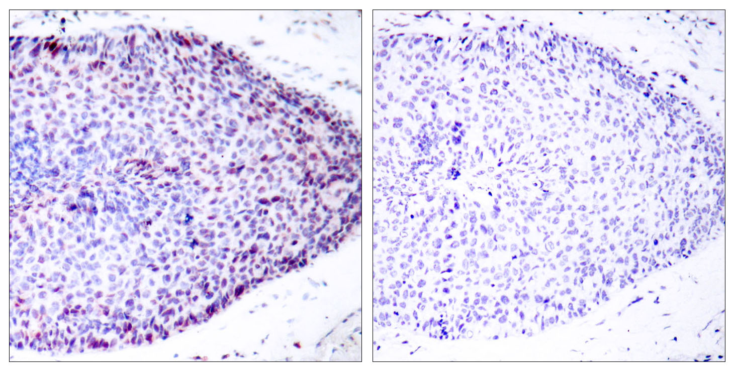 Anti-ATF2 Antibody