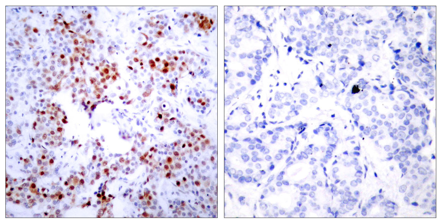 Anti-ATF2 Antibody