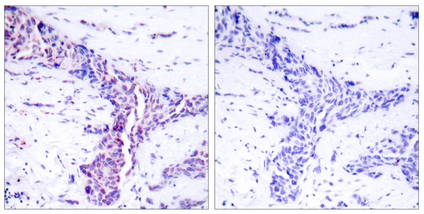 Anti-ATF2 Antibody - Identical to Abcam (ab31483)