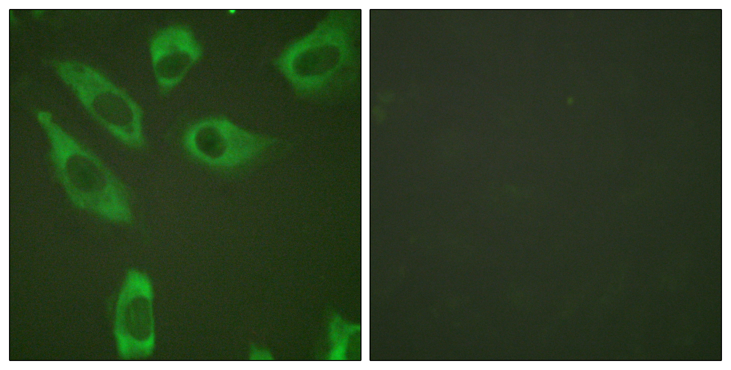 Anti-S6 Ribosomal Protein (phospho Ser240) Antibody