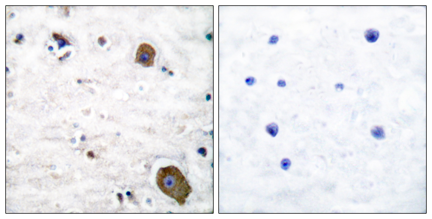 Anti-GFR alpha-1 Antibody