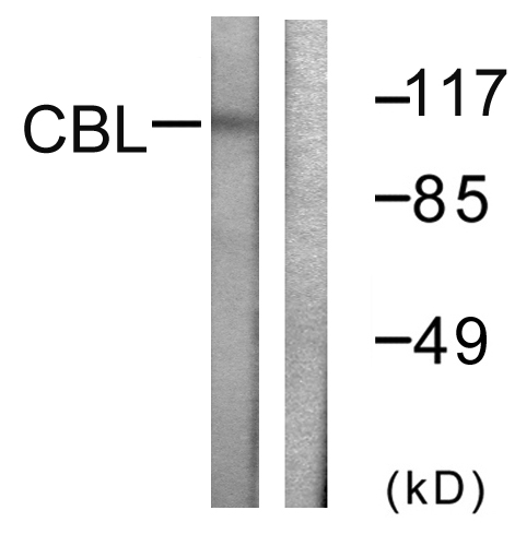 Anti-CBL Antibody