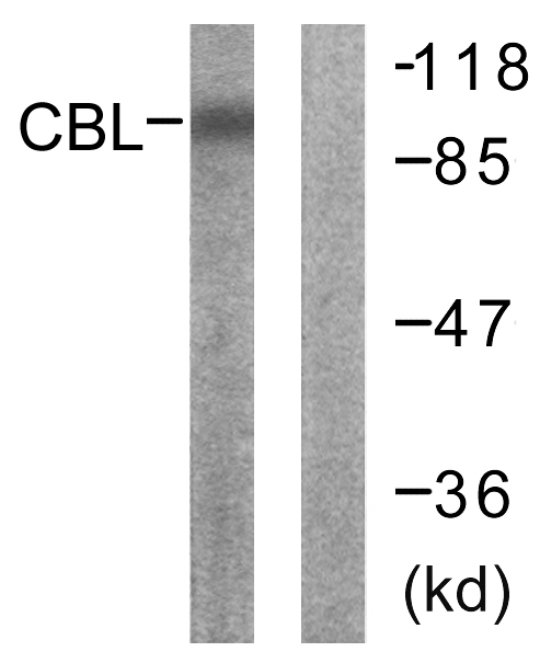 Anti-CBL Antibody