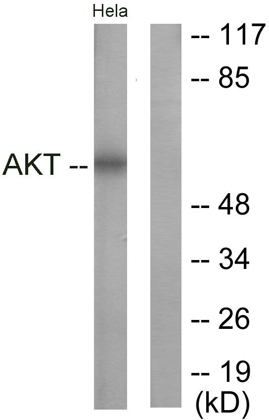 Anti-Akt Antibody - Identical to Abcam (ab59380)