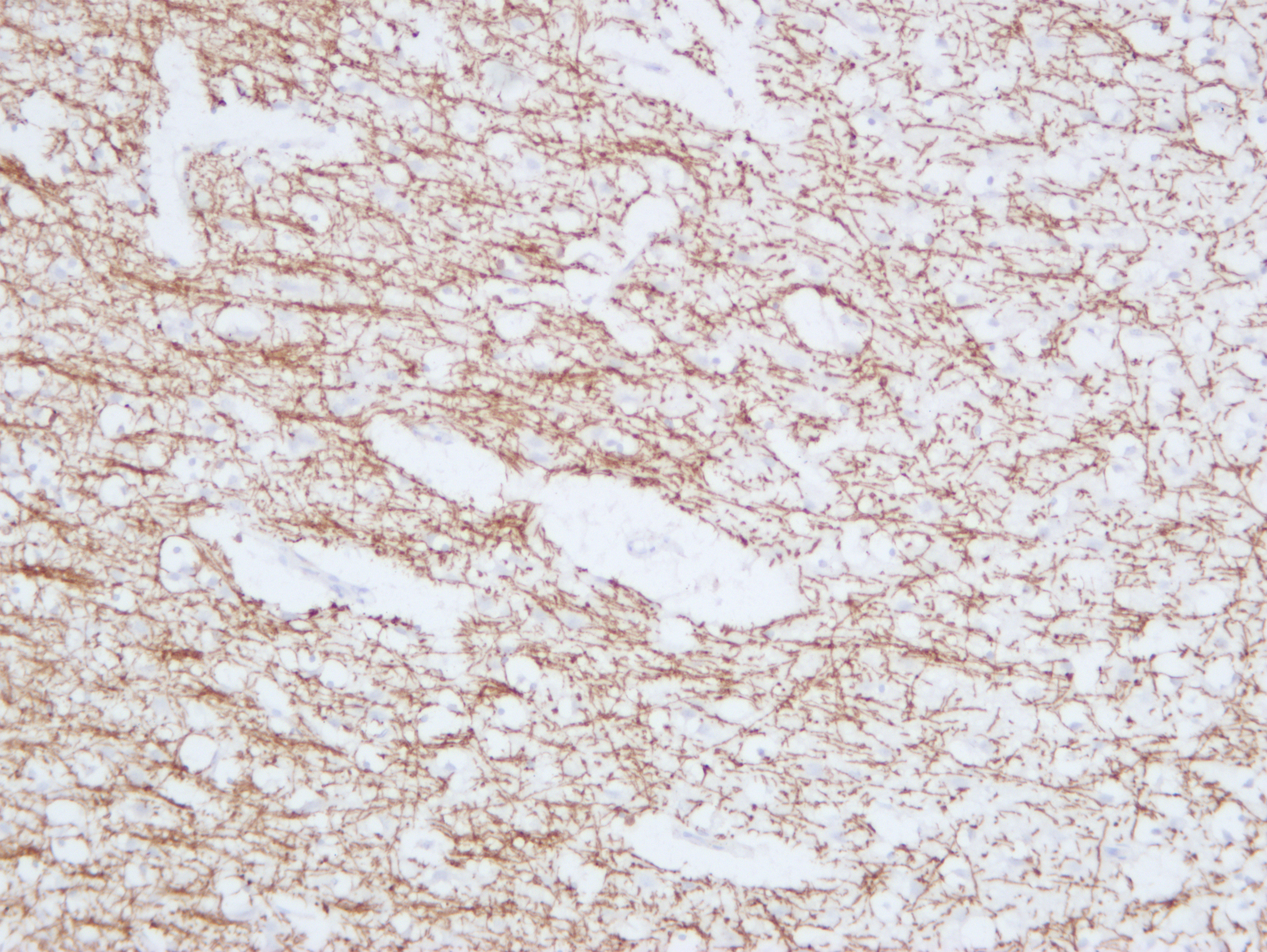 Anti-Myelin Basic Protein Antibody [ABT-MBP]