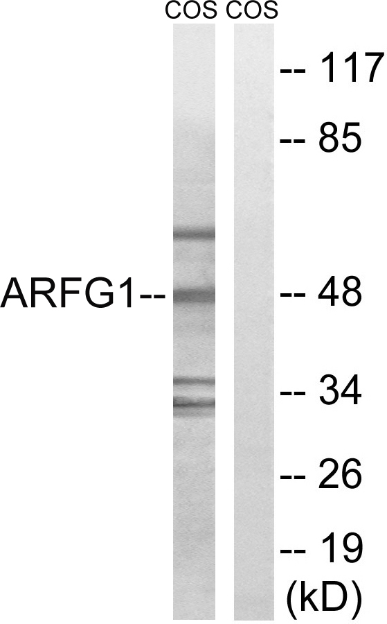 Anti-ARFGAP1 Antibody
