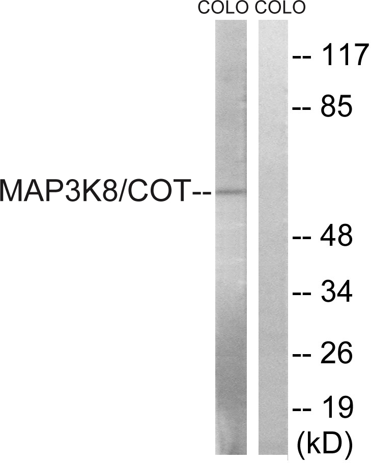 Anti-MAP3K8 Antibody - Identical to Abcam (ab196751)