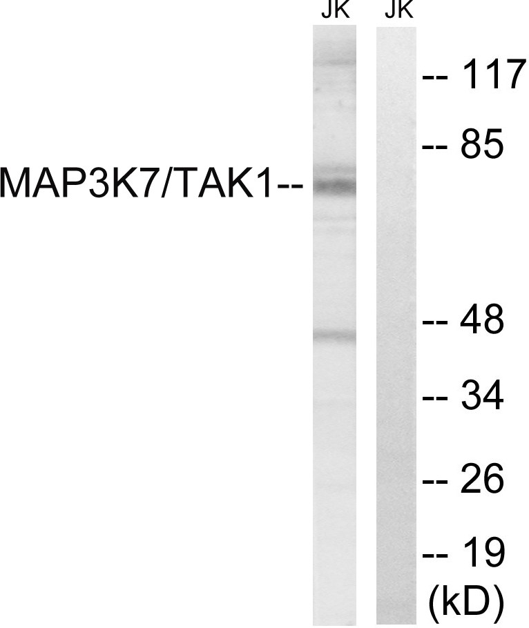 Anti-MAP3K7 Antibody - Identical to Abcam (ab196955)