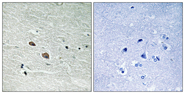 Anti-MAP3K7 Antibody