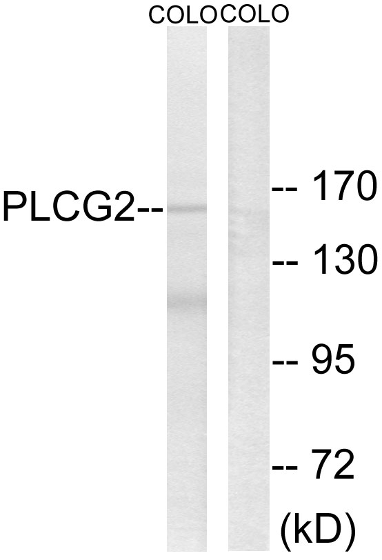 Anti-PLCG2 Antibody