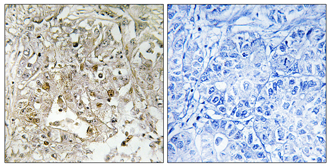 Anti-p38 MAPK Antibody